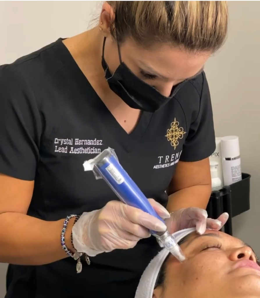 Is Microneedling Just A Reality Show Fad?